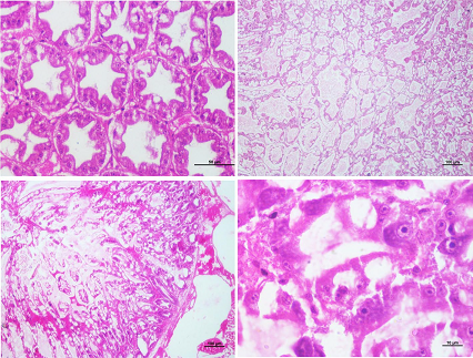 A comparative analysis of different challenge routes against Enterocytozoon hepatopenaei infection in Penaeus vannamei