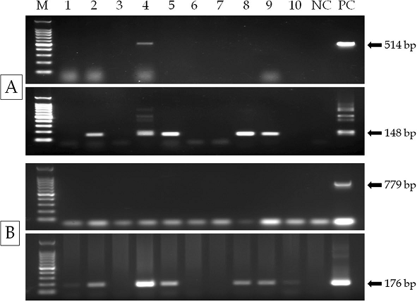 Prevalence of enterocytozoon hepatopenaei (EHP) in Penaeus monodon farms in India