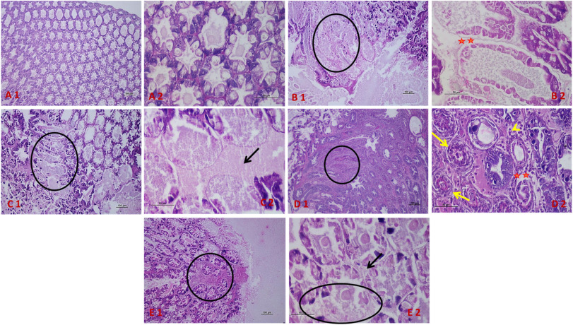 Evaluation of a synergistic blend of short- and medium-chain fatty acids as a dietary intervention for the effective management of Vibriosis in shrimp culture